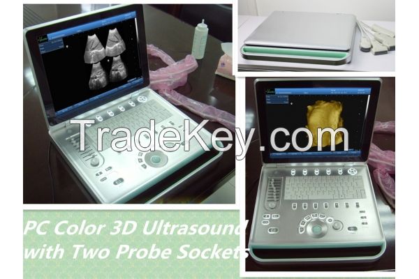 SS-9 PC based laptop digital ultrasound