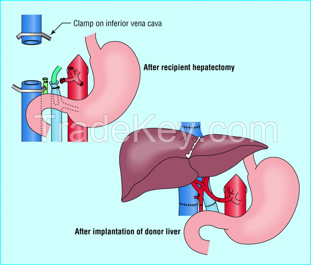 liver, lungs, hearts