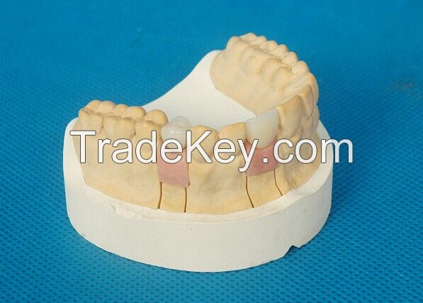 Dental Implant