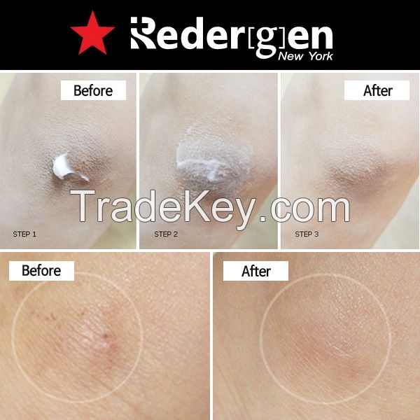 [Redergen] Knee + Elbow Brightening Cream, Dead Cell, Bleaching Whitening Cream, No.1 Aesthetic, Professional, 50g