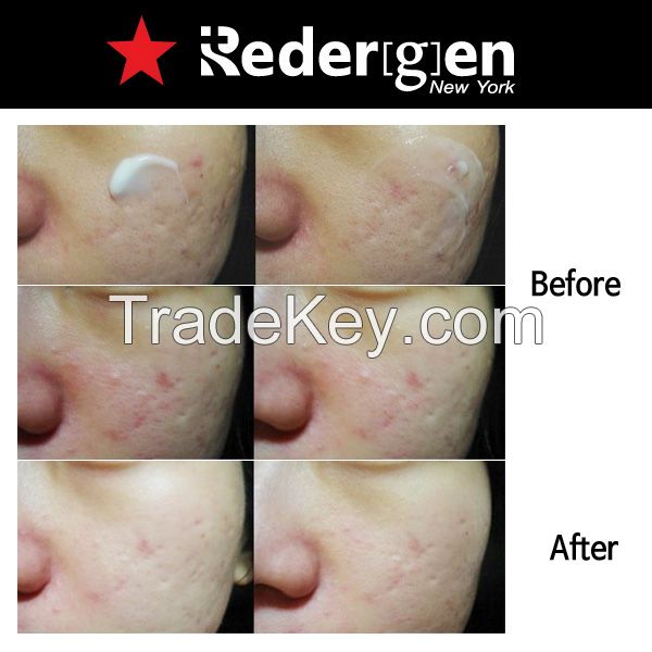 [Redergen] Face Brightening Cream, Whitening Cream, No.1 Aesthetic, Professional, Face, Age Spots, 50g