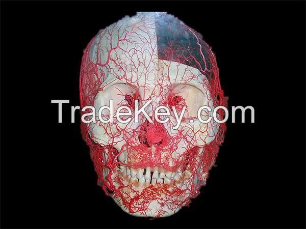 Head artery casting specimens