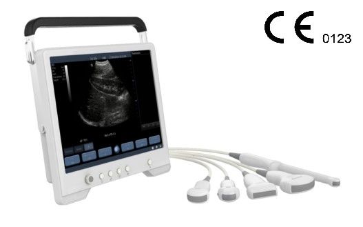 Portable Ultrasound Scanner