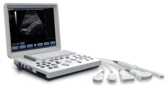 Portable Ultrasound Scanner