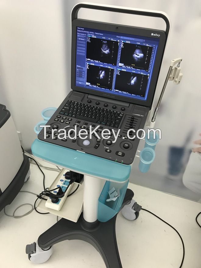 Factory direct sales best sonoscape ultrasound machine S8EXP