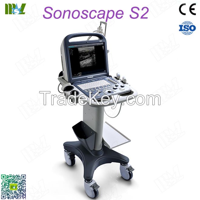 Factory direct sales ecografo sonoscape s2 price lis