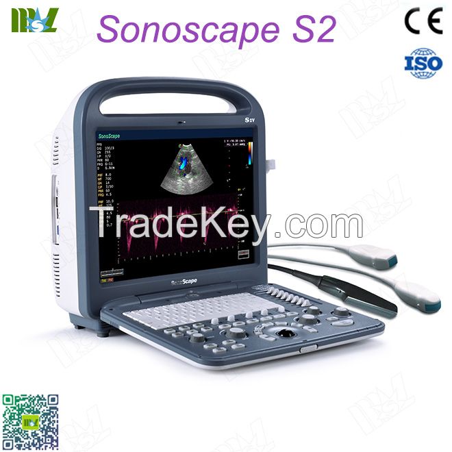 Factory direct sales ecografo sonoscape s2 price lis