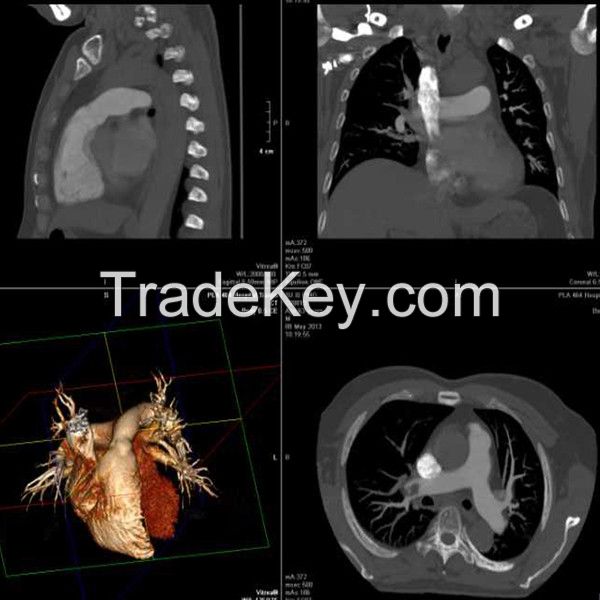 medical x-ray film/dry film