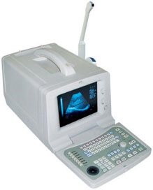 AJ-6100A Portable Ultrasound Scanner