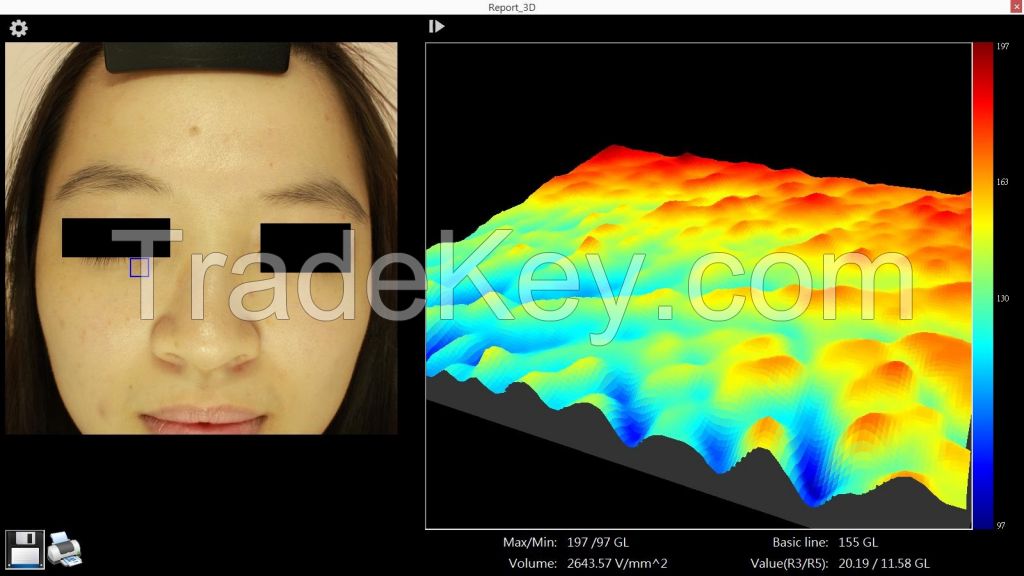 Full-Face Skin IRV