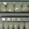 Gold Nail porcelain teeth