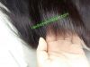 Closure and frontal wi...