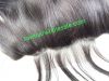 Closure and frontal wi...