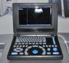 Canyearn A10 Full Digital Laptop Ultrasonic Diagnostic System Black and White Ultrasound Scanner