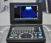 Canyearn A10 Full Digital Laptop Ultrasonic Diagnostic System Black and White Ultrasound Scanner