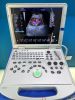 Laptop  Ultrasound Color Doppler scanner diagnostic machine 3D/ 4D model