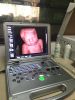 Laptop  Ultrasound Color Doppler scanner diagnostic machine 3D/ 4D model