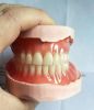 Dental acrylic denture...