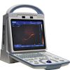 A65 Full Digital Black & White Portable 3D Ultrasound Scanner