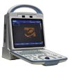 A65 Full Digital Black & White Portable 3D Ultrasound Scanner