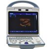 A65 Full Digital Black & White Portable 3D Ultrasound Scanner