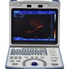 A65 Full Digital Black & White Portable 3D Ultrasound Scanner