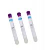 Prp Gel Tubes PRP Tube Vacuum Blood Collection Plasma PRP Gel Tubes Platelet Therapy