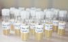 Bee venom - Apitoxin