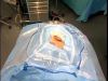 Surgical Drapes