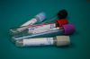 Bloods Testing Tube 