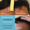 Wound Care Products | ...