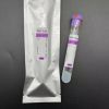 Medical Platelet Rich Plasma 10ml PRP Tube with ACD Gel