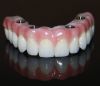 USA Dental Lab Outsour...