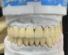 Dental Implant Bar For...