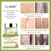 Pain Relief Varicose Veins Cream for Legs To Repair Red Veins