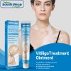 Vitiligo Cream,Vitiligo Treatment for Reduce White Spots and Improve Skin Pigmentation