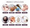 Virtuose Factory Directly Wholesale Mini PRP Kit for Facial