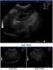 Laptop Ultrasound Scanner for Animal Health Diagnosis