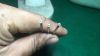 Ultra fine 0.05mm hole...