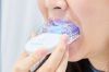 Teeth Whitening Kits &...
