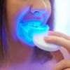 Professional Teeth Whi...