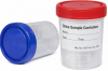 Urine Sample Container