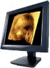 3D ultrasound video ca...