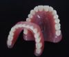 Ceramic Denture