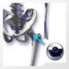 Head Hip Prothesis