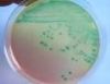 TTC Nutrient Agar Base