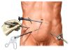 Laparoscopy instruments