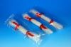 agar   strip