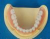 Dental Removable Acryl...