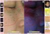 AES-SKII(Skin analyzer...